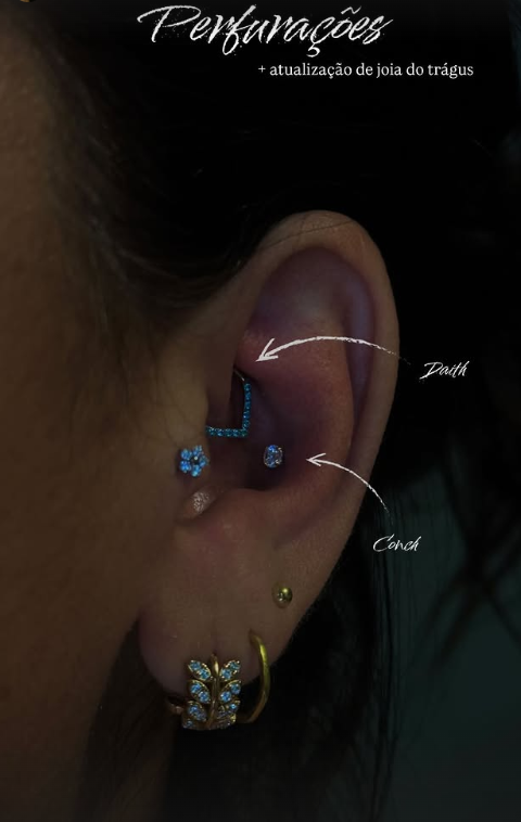 Perfurações daith e conch